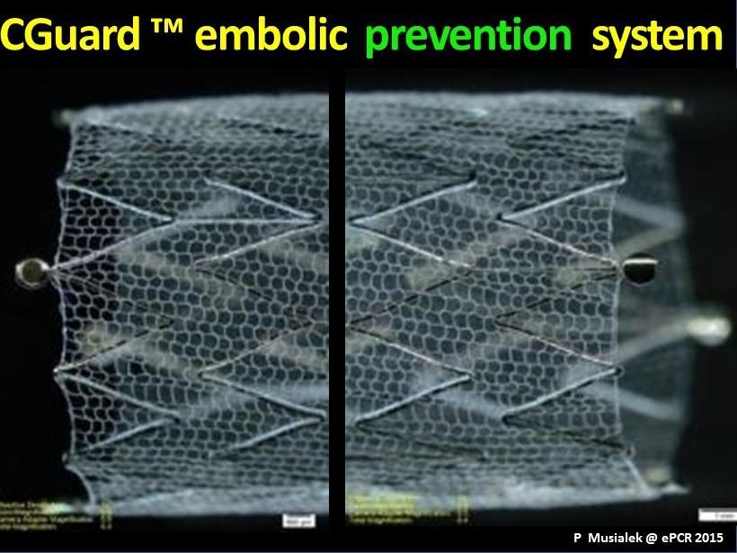 micromesh stent :