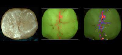 for quantification of dental