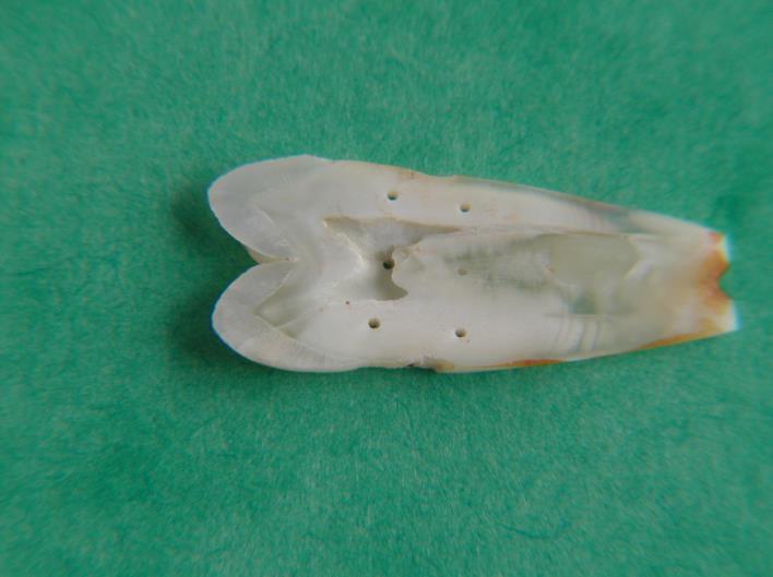 dentine with