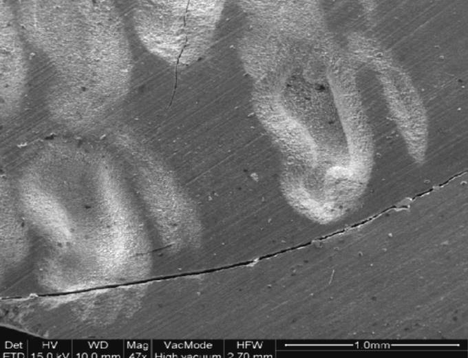 Er:YAG laser CO 2