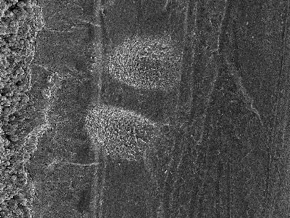 output of the Q-switched Er:YAG laser.