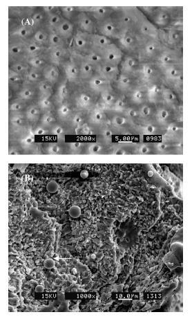 «Compositional and morphological changes of human dentin after Er:YAG laser irradiation» Bor-Shiunn Lee, Yu-Lin Hung, Wan-Hong Lan* International Congress Series 1248 (2003) 143 152 (A)