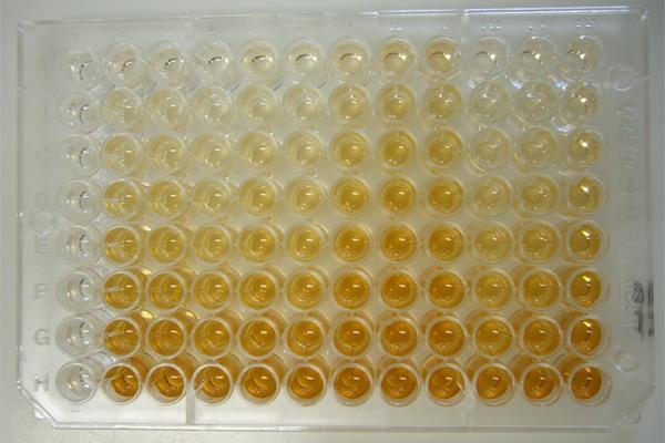 ΜΕΘΟΔΟΣ ELISA
