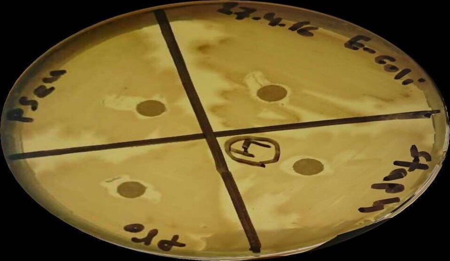 E coli كما في شكل رقم )4(.