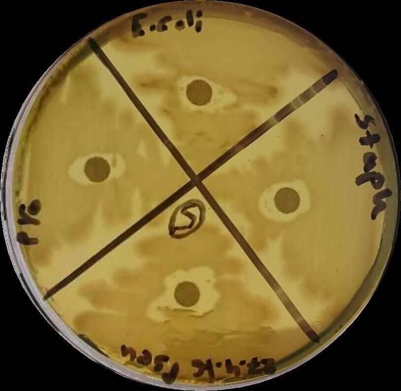 5 -املستخلص رقم )5(:- نلحظ على أكبر تأثير تفاوت بكتيريا المستخلص هذا ا لجناس على Pseudomonas sp. Staphylococcus sp. شكل )5( على أقل وبدرجة المختبرة أقل وبدرجة Proteus sp.