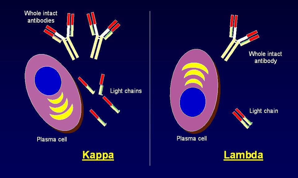 Πως παράγονται οι ελεύθερες ελαφρές αλυσίδες Για άγνωστους λόγους τα πλασματοκύτταρα παράγουν περισσότερες ελαφρές
