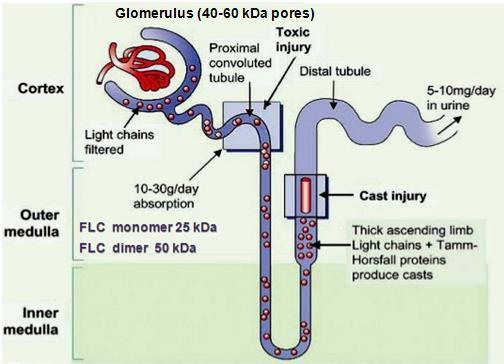Ελεύθερες ελαφρές αλυσίδες (FLCs) Φυσιολογική παραγωγή: FLCs 0,5 g/ημέρα Νεφρός: απορρόφηση μεταβολισμός 10-30 gr/ημέρα (30 φορές της φυσιολογικής παραγωγής FLCs) Η περίσσεια των ελεύθερων ελαφρών