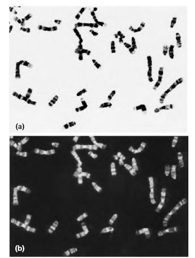 Bandarea cromozomilor pentru identificarea perechilor