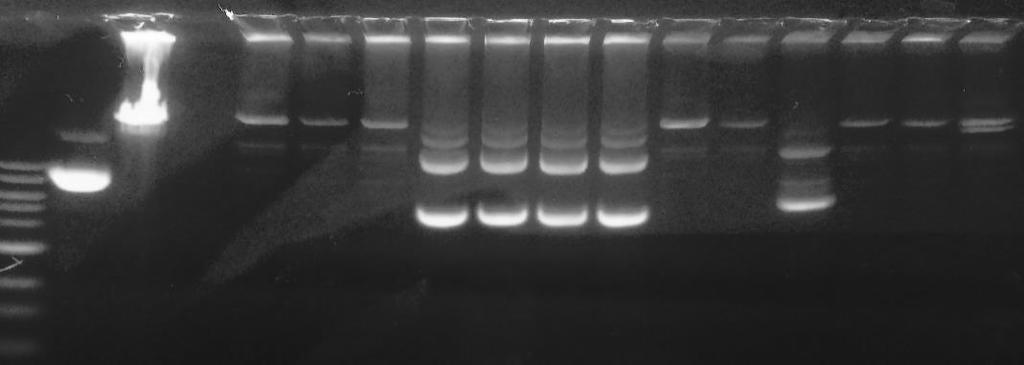 Μ_1 kb padtrackcmv-c3g padgfp #2 #3 #4 #5 #6 #7 #8 #9 #10 #11 #12 #13 #14 Ρόλος της APOC3 στη λειτουργικότητα της HDL και στη μεταβολική δραστικόητα του λιπώδους ιστού όγκος (1:1)
