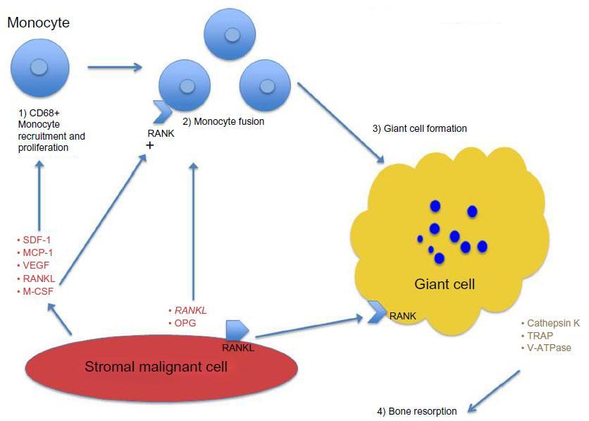 2Α. Νεοπλάσματα πλούσια σε γιγαντοκύτταρα - γιγαντοκυτταρικός όγκος - φυσιολογία Το νεοπλασματικό κύτταρο είναι το μονοπύρηνο ατρακτόμορφο Εκκρίνει χημειοτακτικά μόρια, κύριο RANK που προσελκύουν
