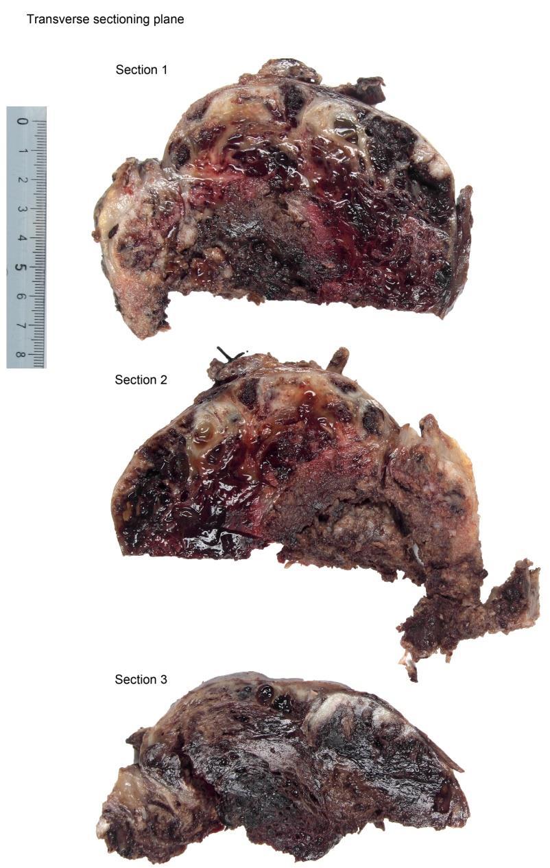 of Pathology UOA-1 st Dept