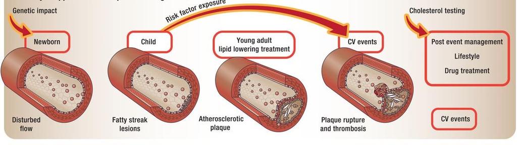 Οικογενής υπερχοληστερολαιμία (Υπερλιποπρωτεϊναιμία τύπου ΙΙ) Η διαδικασία της αθηροσκλήρωσης ξεκινάει από την εμβρυϊκή ζωή με εναπόθεση της LDL-C στο