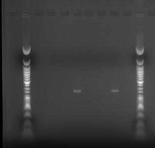 0,1 ml EDTA 0,5M 500 mg BET solid H2O distilată qsp 50 ml. Pentru realizarea unui gel mic au fost adăugaţi în consecinţă 25 μl soluţie mamă BET la 50 ml soluţie agaroză.