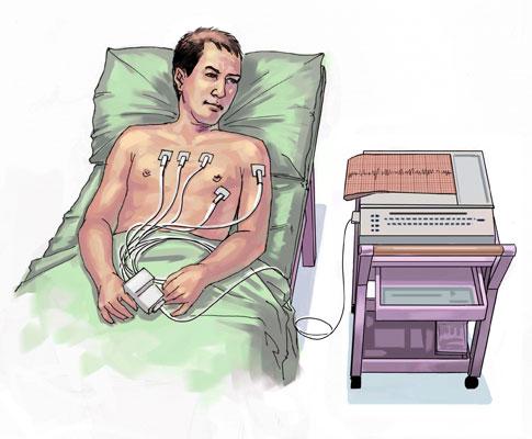 Lasīt elektrokardiogrammu Pieredzējušam ārstam-kardiologam