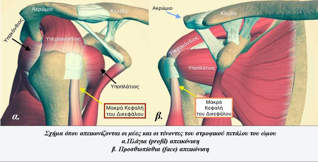 10. ΡΗΞΗ ΜΥΟΤΕΝΟΝΤΙΟΥ ΠΕΤΑΛΟΥ ΩΜΟΥ (Musculotendinous Or Rotator Cuff Rupture) Ορισμός, εισαγωγή Πρόκειται για πλήρη ή μερική ρήξη ενός ή περισσοτέρων τενόντων του στροφικού πετάλου κοντά στην