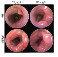 أبحاث ملخصات األبحاث الخالا التائة تعتمد على إترلوك 21 - والبروت ]CD 40 ] كمحر ك رئس لتكو خالا بائة مظمة موج بة للبروت السكر )CD5+( متجة إلترلوك 10 -.