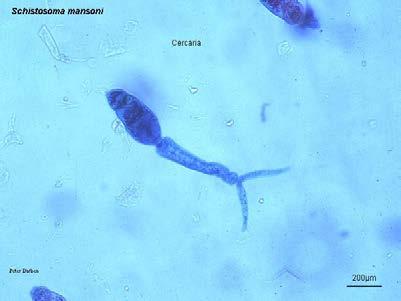 Μερικοί τρηματώδεις σκώληκες ιατρικού ενδιαφέροντος Schistosoma (mansoni, hematobium, japonicum) Διαδερμική