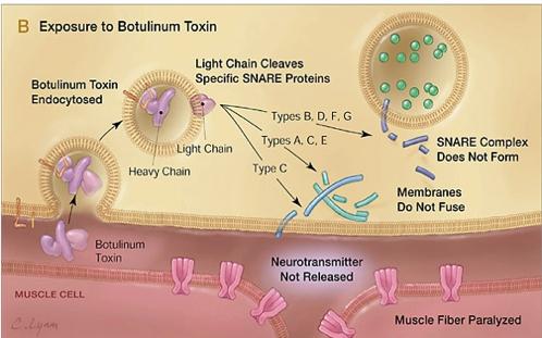 νόσος Clostridium botulinum Νευροτοξίνη (Bo linum toxin):