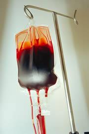 Iron-loading in thalassemia 200 250 mg iron: Whole blood: 0.47 mg iron/ml Pure red cells: 1.16 mg iron/ml Porter JB.