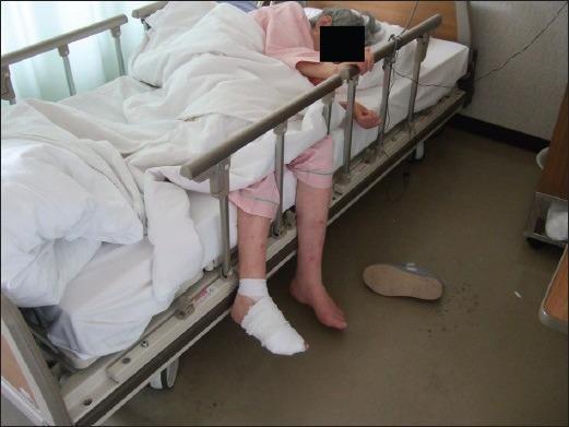 (αναγκαστικές θέσεις, ακροδυνία) Κρικέλης Ι.Ν.