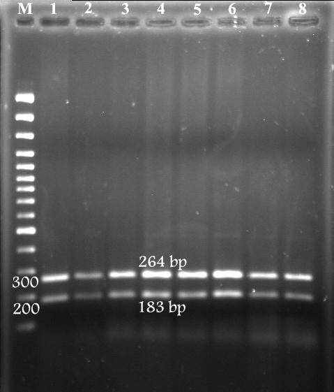 (() - - - - - -) Pinb-D1e.(bp DNA Ladder Plus) DNA (P. /).