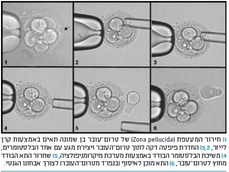 התפתחות, מניעה וגילוי מוקדם של סרטן המעי הגס תמונה מס 3: דגימת טרום-עובר באבחון גנטי טרום השרשה ]13[ )באדיבות פרופ דלית בן יוסף( 2 מניעה 2.