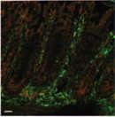 Structures of actin-like ParM filaments show architecture of plasmidsegregating spindles T Bharat et al doi:10.