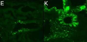 Avian virus Swine virus Bronchioles De