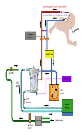 Patients Successfully Treated With ECMO for Confirmed