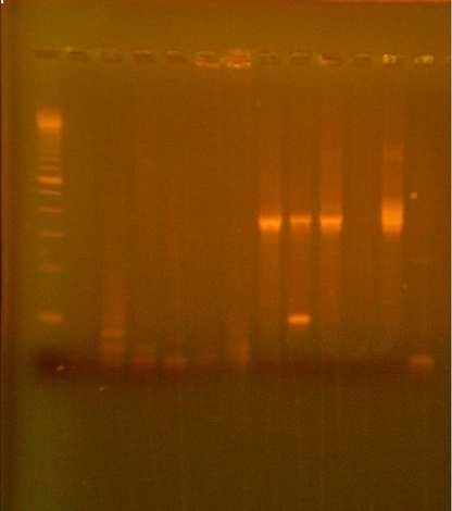 3.3 Ανίχνευση µεταγράφων (mrna) E6/E7 στα HPV 16 (+) δείγµατα Σε όλα τα HPV16 θετικά δείγµατα, ήτοι στα 13 βιοπτικά και στα 7 των κολποτραχηλικών επιχρισµάτων (thin prep) έγινε RT-PCR και nested PCR