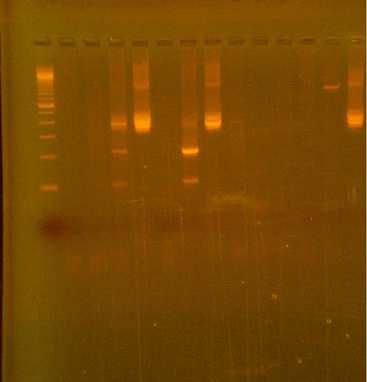 cdna DNA cdna DNA 868 868 793 793 1 2 3 4 5 6 7 8 9 10 11 12 13 14 600bp 405bp 220bp 130bp Φωτ 3.