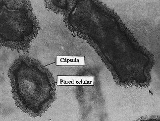 4.4. Capacidade lesional As alteracións celulares e tisulares provocadas polas bacterias patóxenas poden ser producidas por acción directa, mediante a produción de toxinas, ou por acción indirecta,
