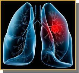 Примери фрактала у људском телу Систем за дисање има фракталну структуру. Састављен је од цевчица кроз које пролази ваздух у алвеоле.