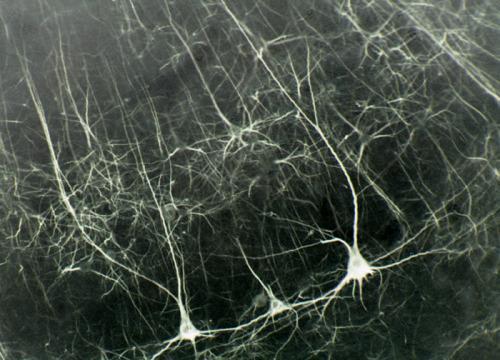 νευρώνων προέρχονται από τον προκινητικό και συμπληρωματικό κινητικό φλοιό
