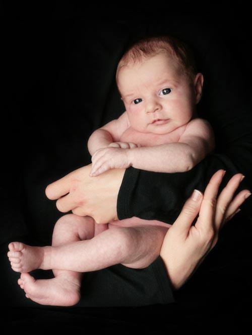 Baby with galactosaemia
