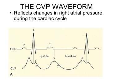 CVP (κεντρική φλεβική πίεση)
