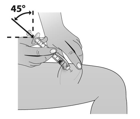 Cu cealaltă mâna, ţineţi seringa ( ca un creion) la un unghi de 45 grade de piele. Printr-o mişcare scurta, introduceţi acul în piele.