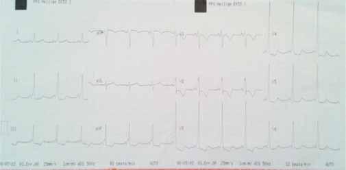 308 se amestece în atriul stâng cu sângele arterial venit prin venele pulmonare; fluxul pulmonar este mult redus.