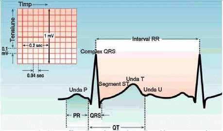 Caracteristicile parametrilor ECG Reprezentarea ECG a fiecărui ciclu cardiac conţine: - unde: P, Q, R, S, T şi U (deflexiuni pozitive sau negative). - segmente: porţiunile cuprinse între unde.