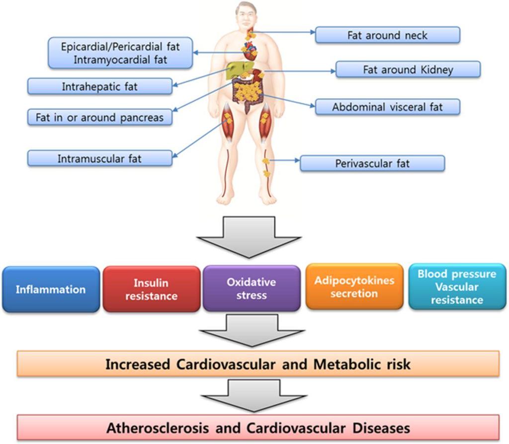 Εκτοπο λίπος και CVD κίνδυνος Lim S et al.