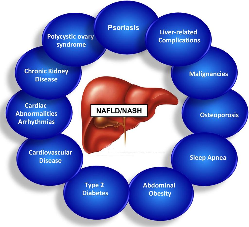 Non-alcoholic fatty liver disease (NAFLD):