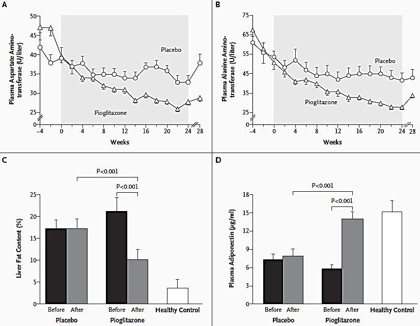 Πιογλιταζόνη 78 RT (38 NASH, 40 NAFLD) Μετα-ανάλυση LF, TZD, Met, antioxidants ΤΖ Βελτίωση ιστολογικής εικόνας Γλυκαιμικού & λιπιδαιμικού προφίλ Θετική