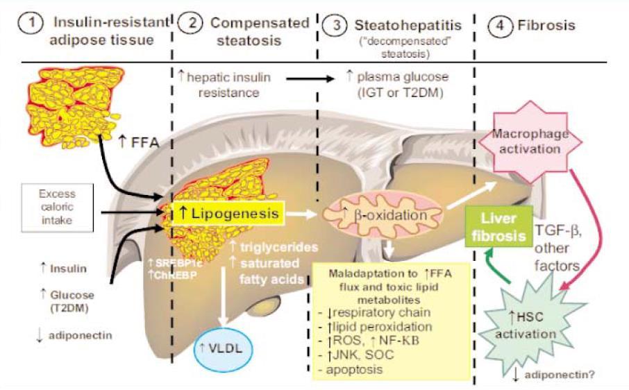 NAFLD και NASCH Krawczyk M. et al.