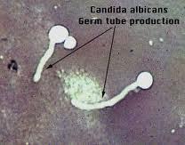 kroz germinacionu poru i obrazuju