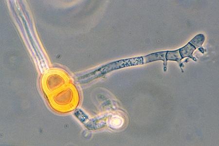 Pre pojave germinacione cevčice mnoge