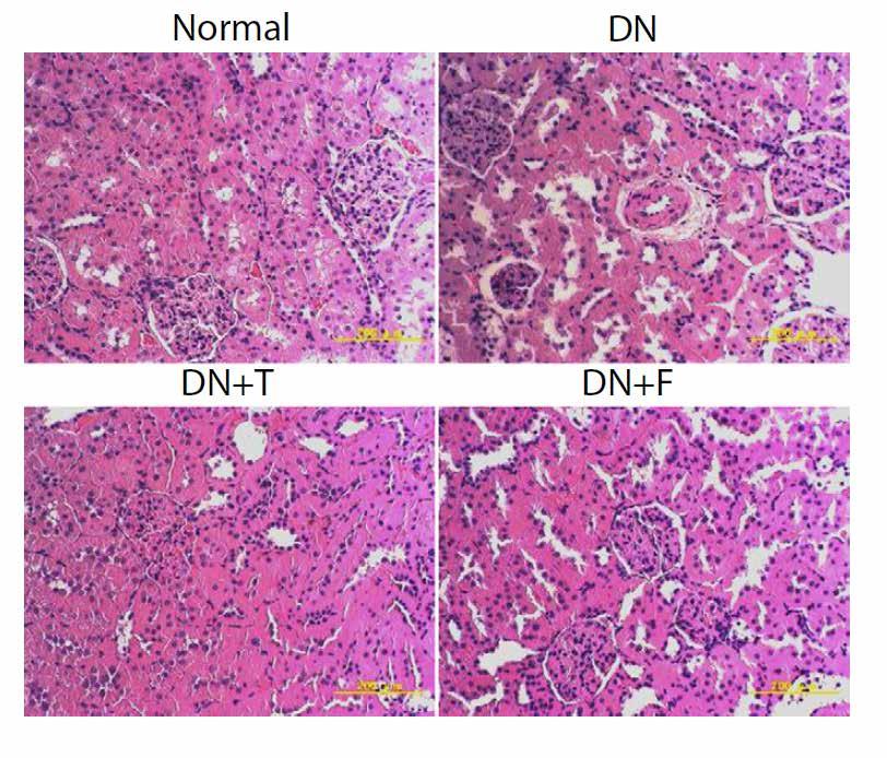 Loop diuretics Renal fibrosis