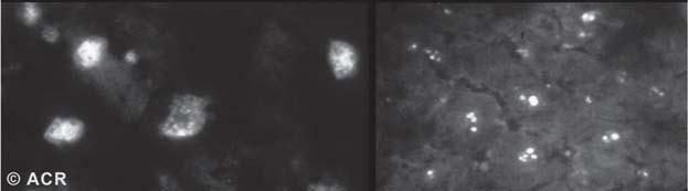 proteins/peptides, etc) Different patterns observed Different