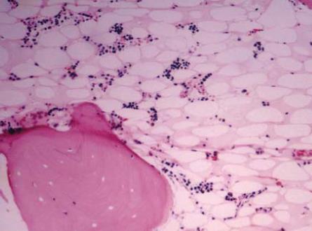 κυτταρικών στοιχείων του μυελού-