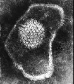 ) Irregular structures often seen in micrographs are artifacts of distortion from negative staining Nucleocapsid contains core of protein wrapped in genomic DNA HUMANI HERPESVIRUSI OZNAKA VIRUS
