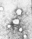 Hepatitis D (delta) virus (HDV) antigen HBsAg RNK Hepatitis D virus (HDV) HDV je defektni virus Jednolanĉana (-) RNK Satelitni virus (1977) Ĉestica dijametra 35 nm sadrţi delta antigen okruţen